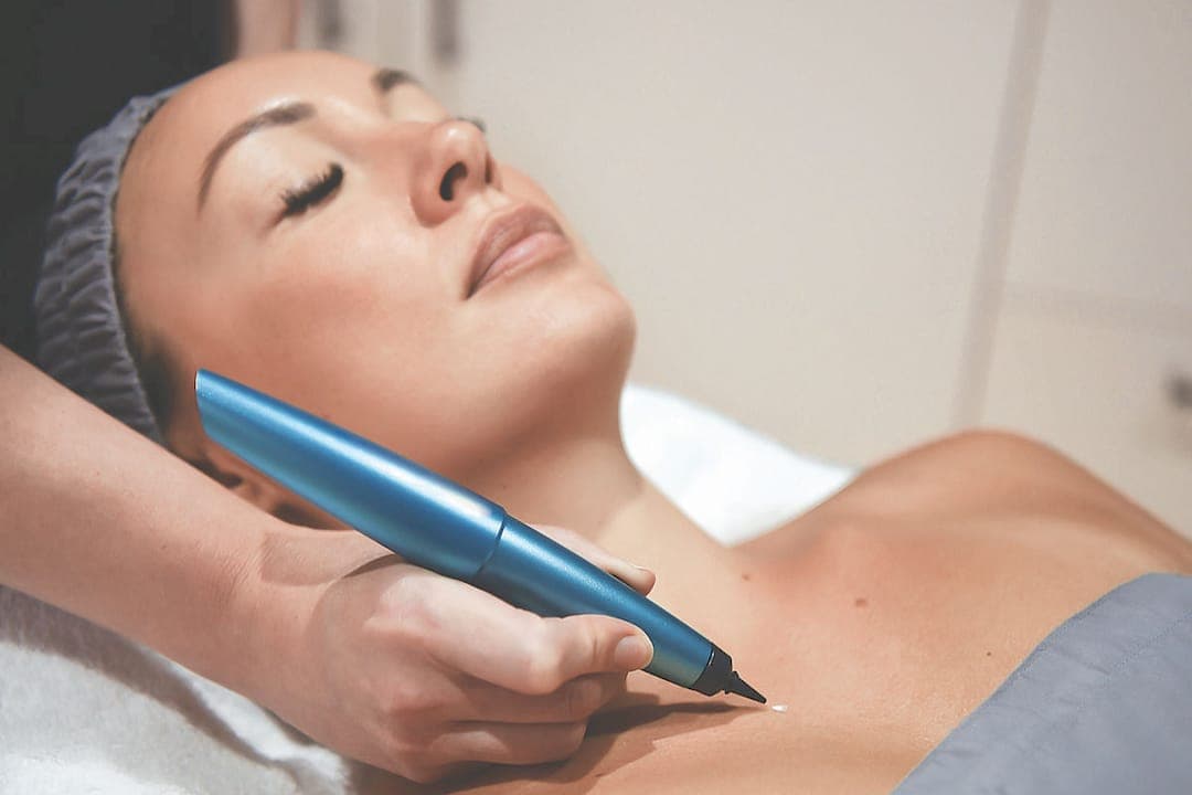 Cryopen treatment : Safe skin tag cryotherapy removal